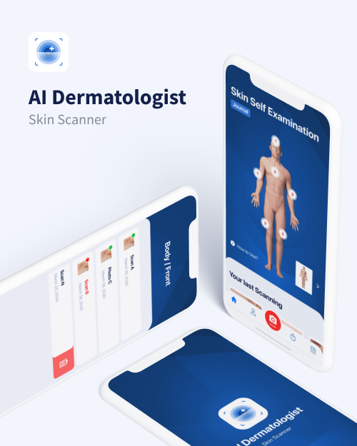 AI Dermatologist